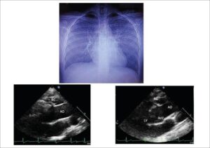 Figure1
