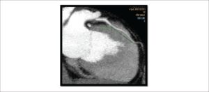 Figura 3