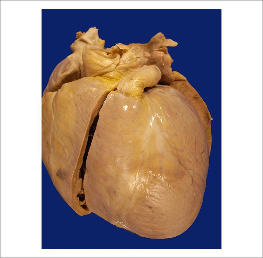 Figura 3