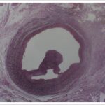 Figura 4