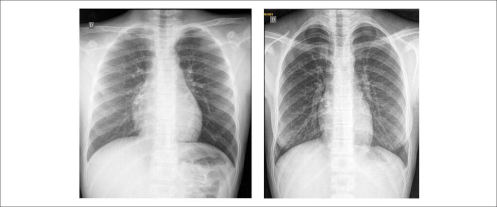 Figure1
