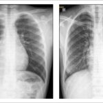 Figure1