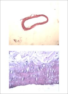 Figura 1