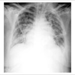 Figura 3