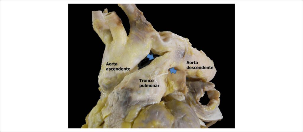 Figura 4