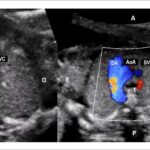Figure 2.2