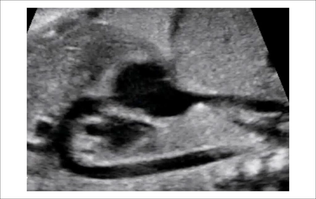 Figure 2.3