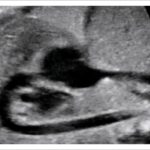 Figure 2.3