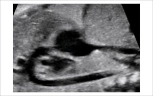 Figure 2.3