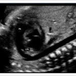 Figure 2.4