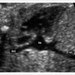 Figure 2.5