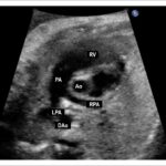 Figure 2.7