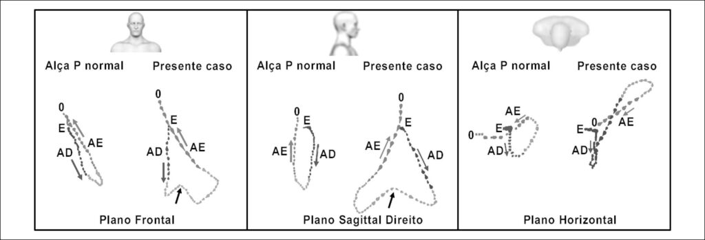Figura 2