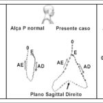 Figura 2