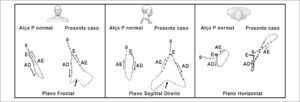 Figura 2