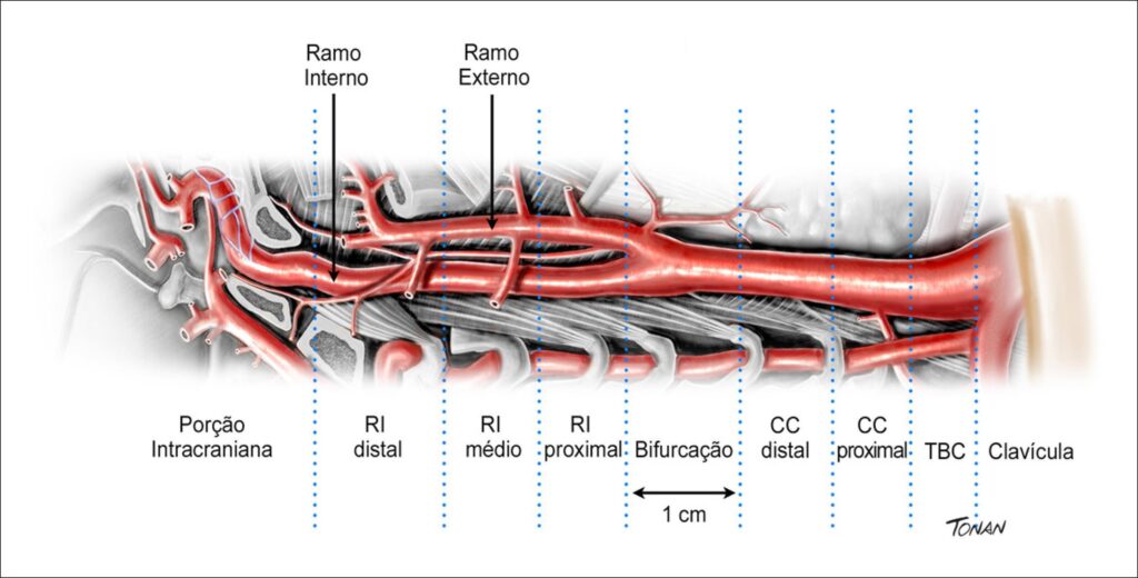 Figura 2