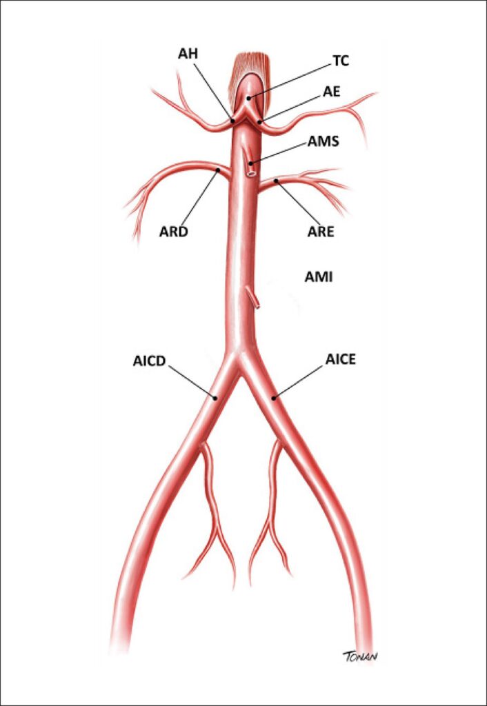 Figura 10