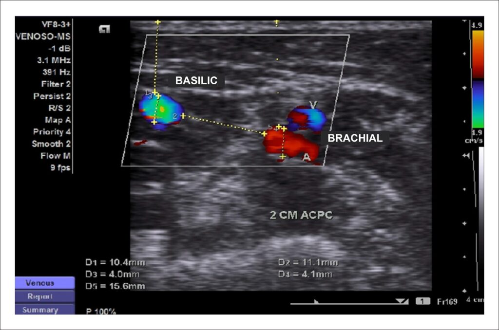 Figure 14