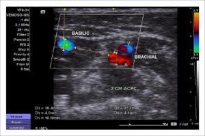 Figure 14