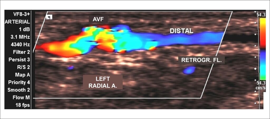 Figure 15