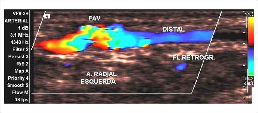 Figura 15
