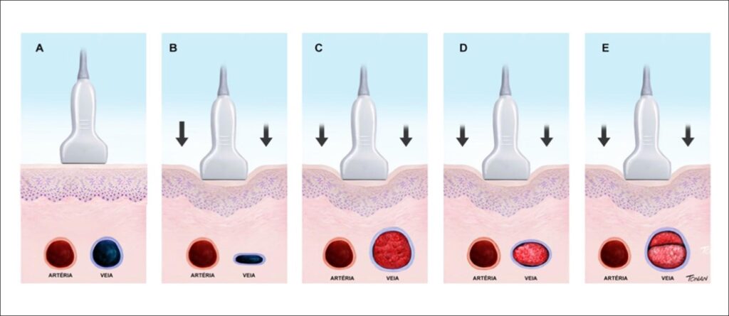 Figure 17
