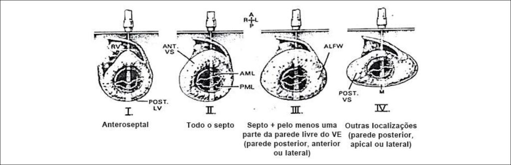 Figura 2