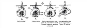 Figura 2