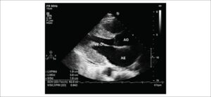 Figura 3