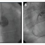 Figure 4 (A and B)