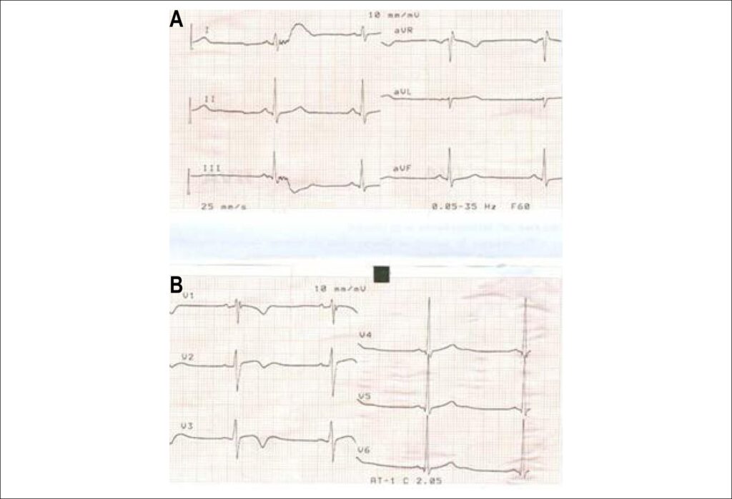 Figure 8 (A and B)