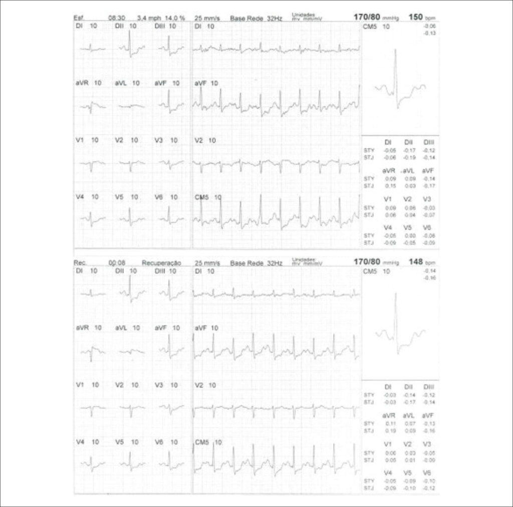 Figure 21