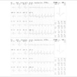 Figure 21