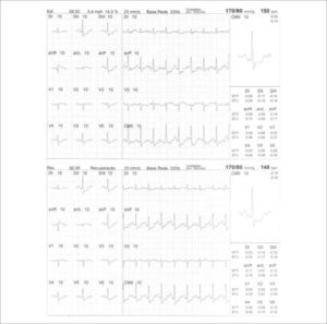 Figure 21