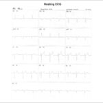 Figure 23