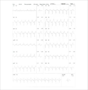 Figure 24
