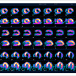 Figure 25