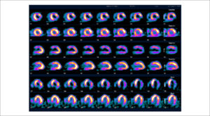 Figure 25