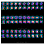 Figure 26
