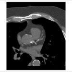 Figure 27