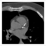 Figure 28
