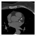 Figure 30