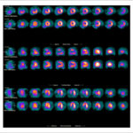 Figure 32