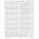 Figure 33