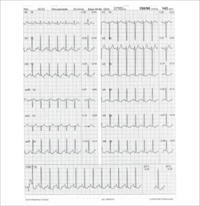 Figure 33