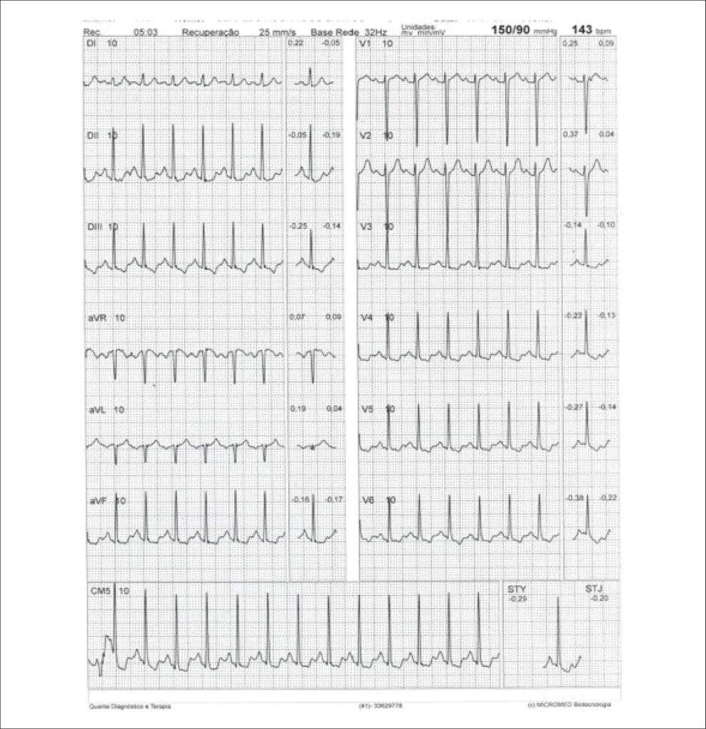 Figure 33