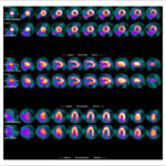 Figure 34