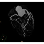 Figure 35