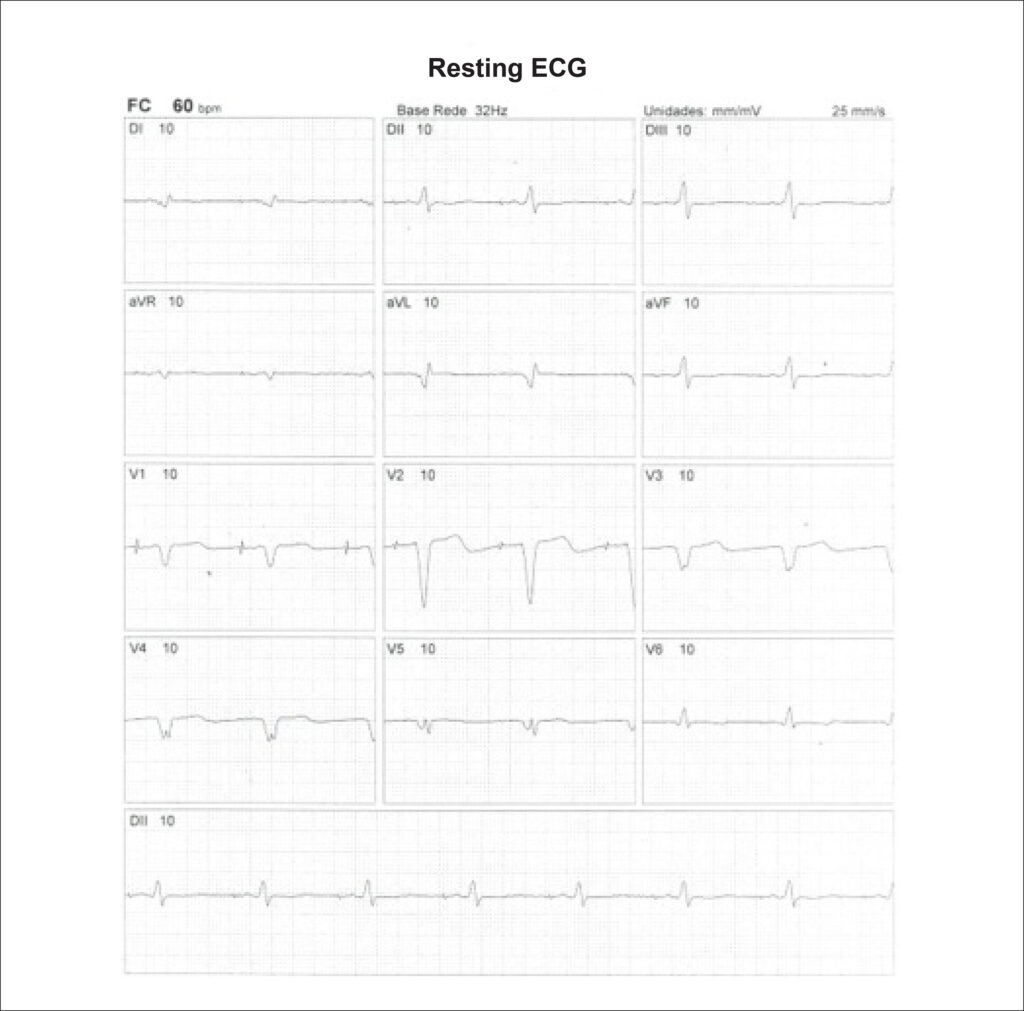 Figure 36