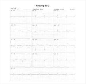 Figure 36
